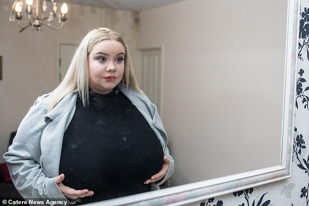 Meet 25 Year Old Lady With Gigantic Breasts That Wont Stop Growing Due To A Rare Condition 