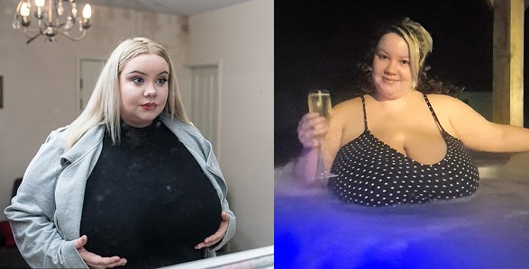 UK Woman's Breasts Won't Stop Growing! Mother With 48J Bra Size Suffers  From Macromastia