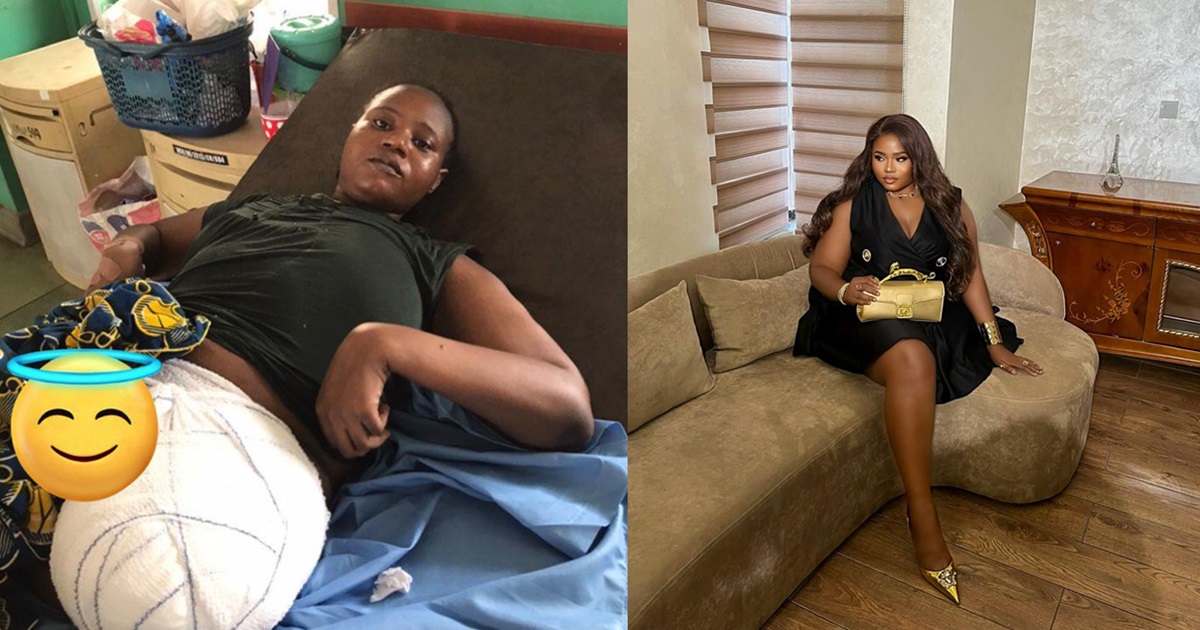 Nigerian Lady Celebrates One Year Of Surv1val After Los!ng Her Leg Due To Cancer (PHOTOS)